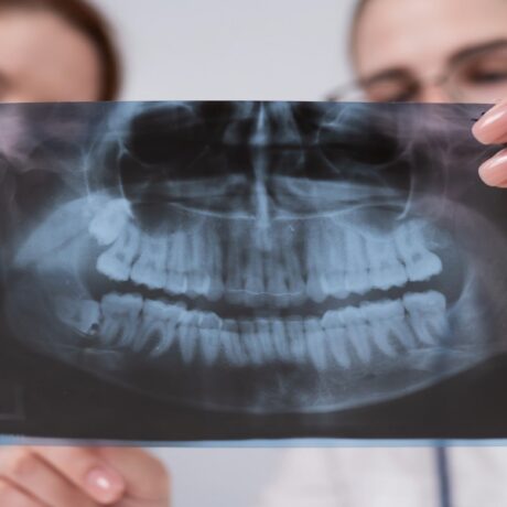 علت لق شدن دندان بعد از عصب کشی