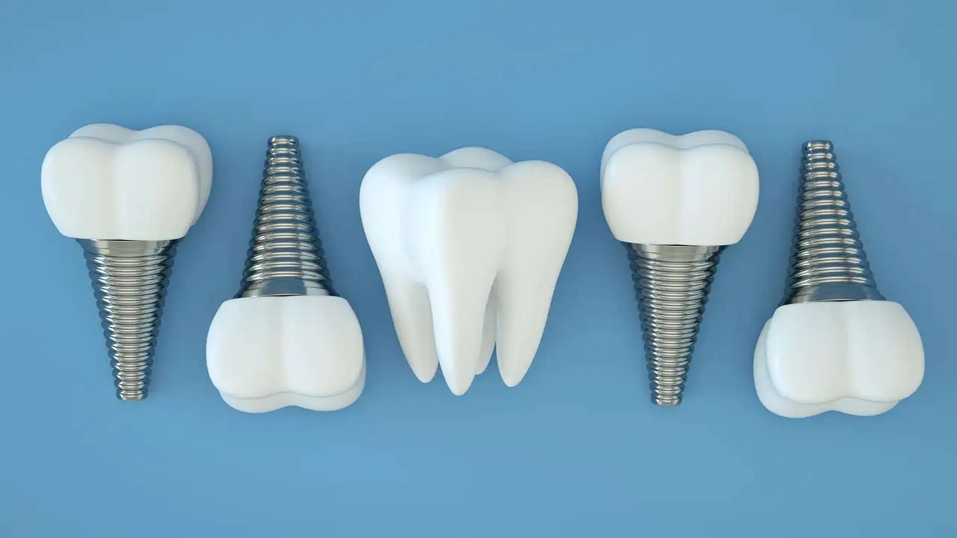 اگر پیج ایمپلنت بیفتد چه کنیم؟ دلایل و راههای پیشگیری