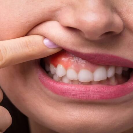 درمان ورم صورت در اثر دندان درد در طب سنتی + 10 روش کاربردی