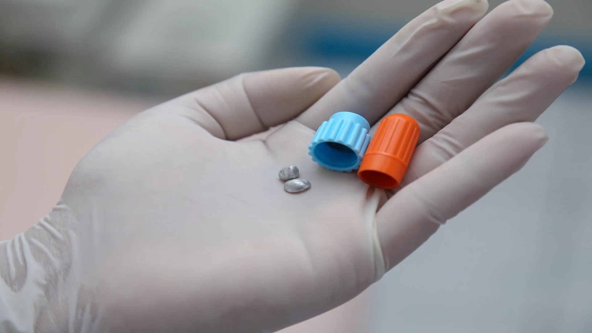 آمالگام چیست و چه کاربردی در دندان پزشکی دارد؟